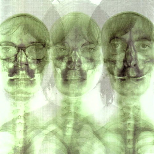 Supergrass
