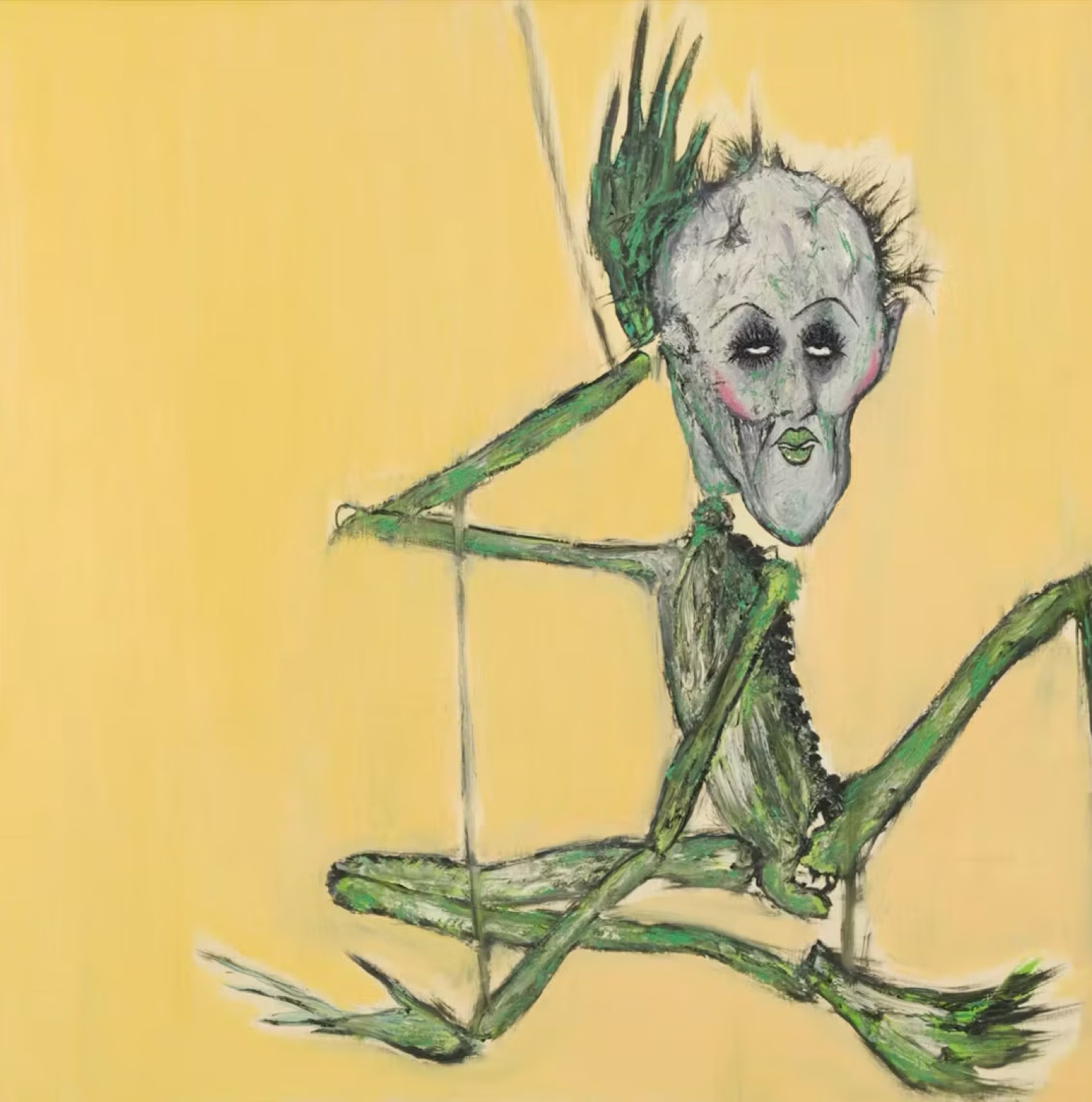 Fistula, Kurt Cobain